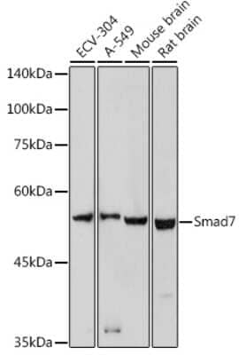 Western Blot: Smad7 AntibodyAzide and BSA Free [NBP2-93969]